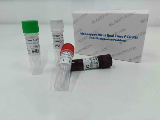 Amostras rápidas do exsudado da lesão do soro de Kit Real Time For Human do teste do PCR do vírus de Monkeypox